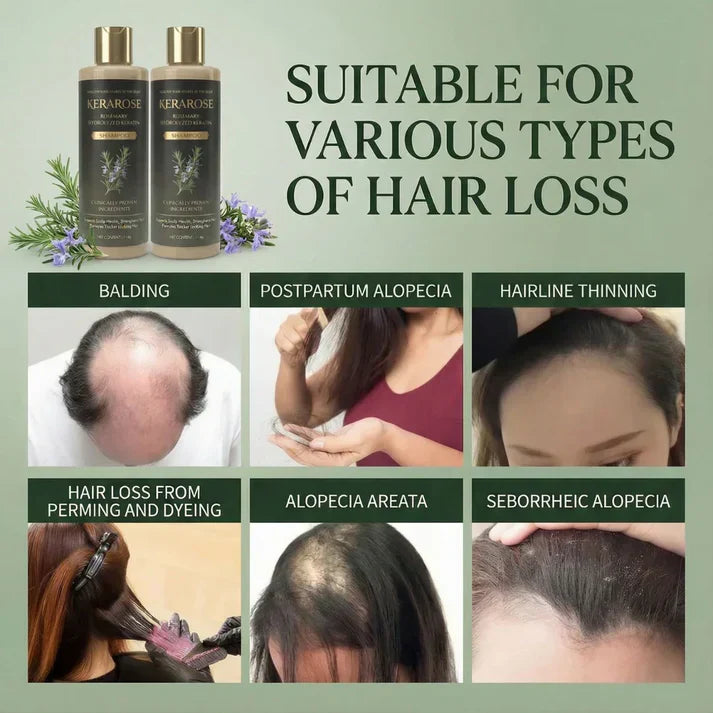 Kerarose Rosemary Shampoo For Hair Growth