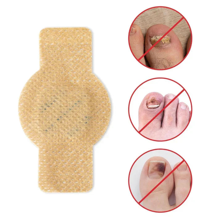 NailHeal™ - Fungal Nail Patches 🌿💅